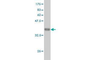 Western Blotting (WB) image for anti-Ribosomal Protein L9 (RPL9) (AA 93-191) antibody (ABIN562692)