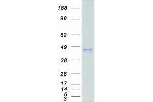 Western Blotting (WB) image for Activator of HSP90 ATPase Activity 1 (AHSA1) protein (Myc-DYKDDDDK Tag) (ABIN2714473)