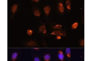 Immunofluorescence analysis of U-2 OS cells using RPL34 Polyclonal Antibody at dilution of 1:100. (RPL34 抗体)