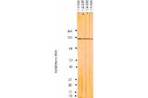 Western Blotting (WB) image for anti-Herpes Simplex Virus Type 2 ICP8 (HSV2 ICP8) antibody (ABIN265565) (HSV2 ICP8 抗体)