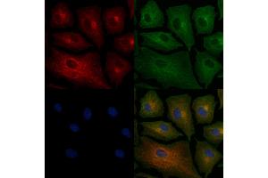 ABIN6258567 and ABIN6276236 staining  cells by IF/ICC. (VN1R2 抗体  (Internal Region))