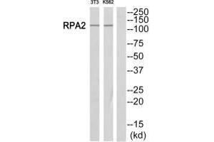 Western blot analysis of extracts from Jurkat/NIH-3T3 cells, using POLR1B antibody.