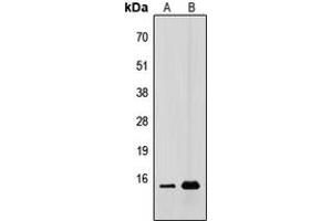 Western blot analysis of CDC42EP5 expression in HEK293T (A), A431 (B) whole cell lysates. (CDC42EP5 抗体  (N-Term))