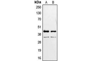 Western blot analysis of PAX2 expression in MCF7 (A), K562 (B) whole cell lysates. (PAX2A 抗体  (Center))