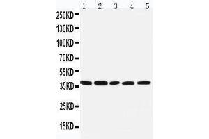 Anti-IRF1 antibody, Western blotting Lane 1: COLO320 Cell Lysate Lane 2: U87 Cell Lysate Lane 3: HELA Cell Lysate Lane 4: JURKAT Cell Lysate Lane 5: MCF-7 Cell Lysate (IRF1 抗体  (Middle Region))