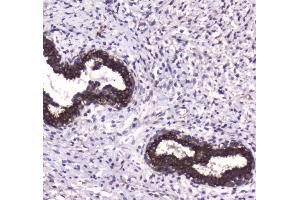 IHC analysis of MAP1LC3A using anti-MAP1LC3A antibody . (MAP1LC3A 抗体  (AA 1-120))