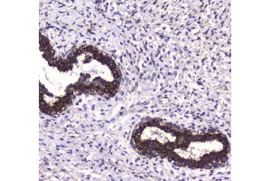 IHC analysis of MAP1LC3A using anti-MAP1LC3A antibody .