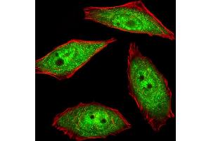 Fluorescent image of U251 cells stained with hNEK2-C410 . (NEK2 抗体  (AA 396-426))
