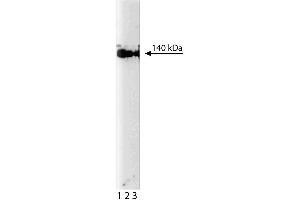 Western blot analysis of eNOS/NOS Type III on human endothelial cell lysate. (ENOS 抗体  (AA 1025-1203))