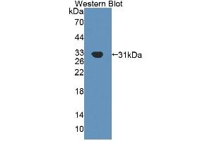 Detection of Recombinant Agrin, Human using Polyclonal Antibody to Agrin (AGRN) (AGRN 抗体  (AA 1329-1548))