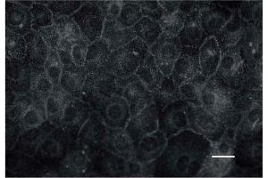 Immunocytochemistry image of NPR-A staining in cultu- red rat inner medullary collecting duct (IMCD) cells.