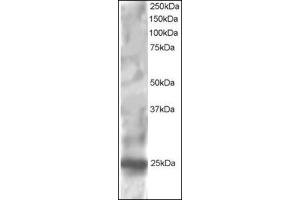 Antibody staining (1 µg/ml) of HepG2 lysate (RIPA buffer, 30 µg total protein per lane). (RGS1 抗体  (C-Term))