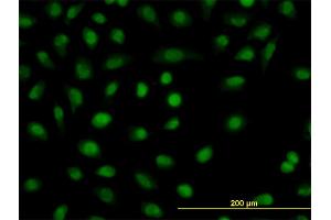 Immunofluorescence of monoclonal antibody to CSDA on HeLa cell.