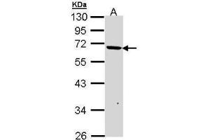 WB Image Sample (30 ug of whole cell lysate) A: A431 , 10% SDS PAGE antibody diluted at 1:1000 (JMJD6 抗体  (Center))