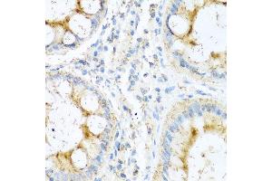 Immunohistochemistry of paraffin-embedded human colon using NTF4 antibody at dilution of 1:100 (40x lens). (Neurotrophin 4 抗体)