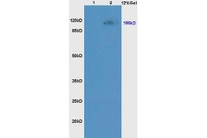 Lane 1: mouse kidney lysates Lane 2: mouse liver lysates probed with Anti NCX1/SLC8A1 Polyclonal Antibody, Unconjugated (ABIN731198) at 1:200 in 4 °C. (SLC8A1 抗体  (AA 801-900))