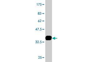 Western Blot detection against Immunogen (35. (HNF1B 抗体  (AA 29-118))