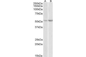 AP21507PU-N Phe Hydoxylase antibody staining of Mouse (A)  and Rat (B) Liver lysate at 0. (Phenylalanine Hydroxylase 抗体  (Internal Region))