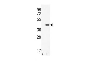 Western blot analysis of CLEC11A (arrow) using rabbit polyclonal CLEC11A Antibody (Center) (ABIN655039 and ABIN2844670). (CLEC11A 抗体  (AA 145-174))