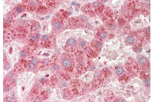 Rabbit Anti-A1BG antibody Catalog Number: ARP33811 Formalin Fixed Paraffin Embedded Tissue: Human Liver Primary antibody Concentration: 1:100 Secondary Antibody: Donkey anti-Rabbit-Cy3 Secondary Antibody Concentration: 1:200 Magnification: 20x Exposure Time: 0. (A1BG 抗体  (C-Term))