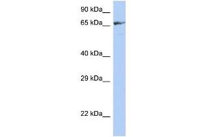 WB Suggested Anti-ZNF676 Antibody Titration:  0. (ZNF676 抗体  (Middle Region))