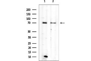 anti-Adrenergic, alpha-2B-, Receptor (ADRA2B) antibody