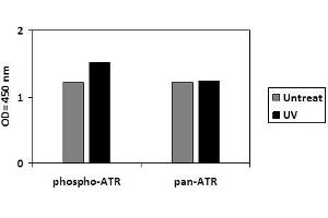 T47D cells were untreated or treated with UV. (ATR ELISA 试剂盒)