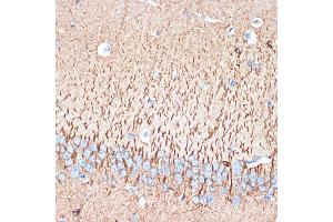 Immunohistochemistry (IHC) image for anti-Activin A Receptor, Type IB (ACVR1B) antibody (ABIN1678826)