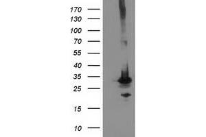 Image no. 4 for anti-Phenylethanolamine N-Methyltransferase (PNMT) antibody (ABIN1500307) (PNMT 抗体)