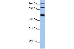 WB Suggested Anti-WDR49 Antibody Titration: 0. (WDR49 抗体  (C-Term))