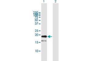 Western Blot analysis of TDGF1 expression in transfected 293T cell line by TDGF1 MaxPab polyclonal antibody. (TDGF1 抗体  (AA 1-188))