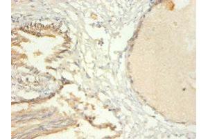 Immunohistochemistry of paraffin-embedded human prostate tissue using ABIN7172712 at dilution of 1:100