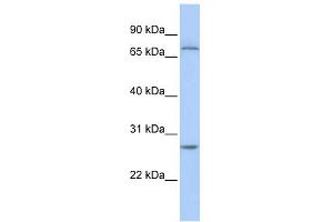 WB Suggested Anti-RCHY1 Antibody Titration:  0. (RCHY1 抗体  (N-Term))