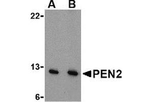 Western Blotting (WB) image for anti-Presenilin Enhancer 2 Homolog (PSENEN) (N-Term) antibody (ABIN1031508) (PEN2 抗体  (N-Term))