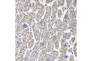 Immunohistochemistry of paraffin-embedded human liver injury using MDH2 Antibody (ABIN1980313) at dilution of 1:100 (40x lens). (MDH2 抗体)