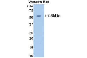 Western blot analysis of the recombinant protein. (AGT 抗体  (AA 23-477))