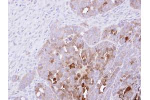 IHC-P Image Immunohistochemical analysis of paraffin-embedded NCIN87 xenograft , using PAI-2, antibody at 1:500 dilution. (SERPINB2 抗体  (Center))