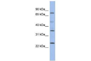 PPM1K antibody used at 1 ug/ml to detect target protein. (PPM1K 抗体)