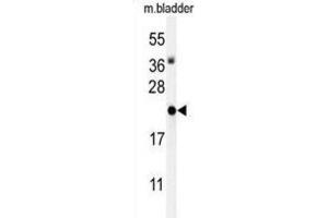 Western Blotting (WB) image for anti-Inhibitor of DNA Binding 4, Dominant Negative Helix-Loop-Helix Protein (ID4) antibody (ABIN3004406) (ID4 抗体)