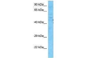 Western Blotting (WB) image for anti-gamma-aminobutyric Acid (GABA) A Receptor, pi (GABRP) (N-Term) antibody (ABIN2792265)
