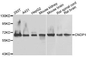 Western blot analysis of extracts of various cell lines, using CNDP1 antibody. (CNDP1 抗体)