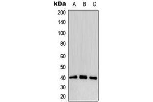 Western blot analysis of CD32b (pY292) expression in MCF7 pervanadate-treated (A), mouse liver (B), PC12 pervanadate-treated (C) whole cell lysates. (FCGR2B 抗体  (C-Term, pTyr292))