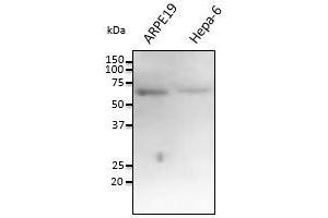 Anti-FTCO Ab at 1/1,000 dilution,at 100 Iane, Rabbit polyclonal to goat lgG (HRP) at 1/10,000 dilution, (FTCD 抗体  (N-Term))