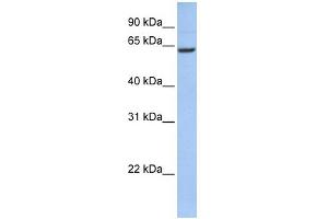 WB Suggested Anti-CCDC67 Antibody Titration: 0. (CCDC67 抗体  (N-Term))