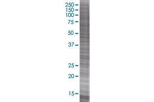 ARG1 transfected lysate (ARG1 293T Cell Transient Overexpression Lysate(Denatured))