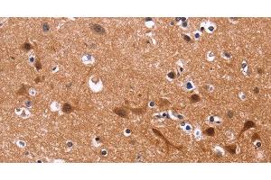 Immunohistochemistry of paraffin-embedded Human brain tissue using MSH4 Polyclonal Antibody at dilution 1:30 (MSH4 抗体)