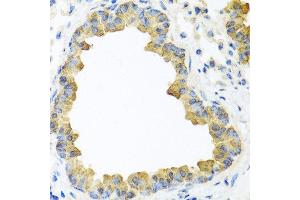 Immunohistochemistry of paraffin-embedded mouse lung using WNT5B antibody at dilution of 1:100 (40x lens). (WNT5B 抗体)