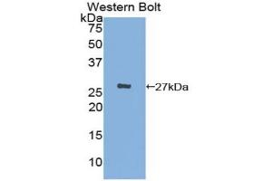 Western blot analysis of the recombinant protein. (CX3CL1 抗体  (AA 83-330))