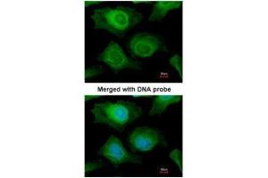 ICC/IF Image Immunofluorescence analysis of paraformaldehyde-fixed HeLa, using AKR1B10, antibody at 1:200 dilution. (AKR1B10 抗体)