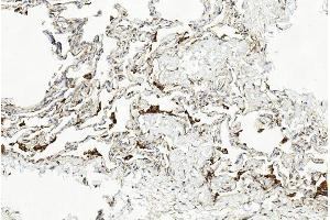 Immunohistochemical analysis of paraffin-embedded Human lung section using Pink1 am1851b. (LAMP2 抗体)